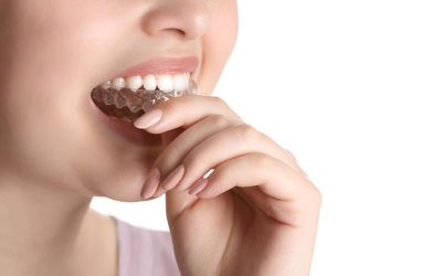 Causas y soluciones para el bruxismo (apretar o rechinar los dientes)