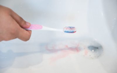Causas del sangrado de encías y soluciones