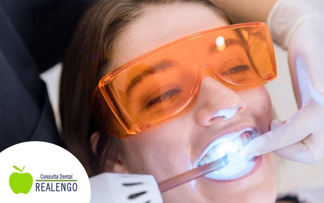 ¿Cuanto dura un blanqueamiento dental?