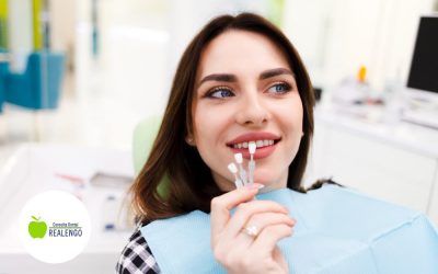 ¿Qué saber de las carillas dentales?
