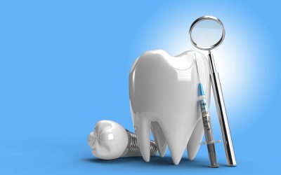 Ventajas de los implantes dentales